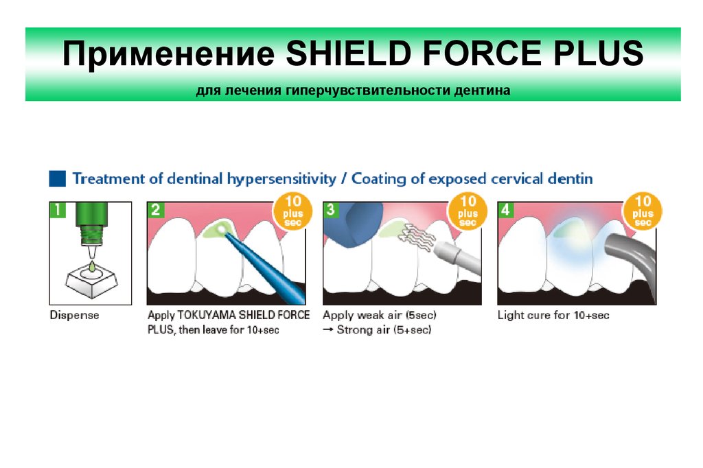Force shield. Адгезив Shield Force. Шилд Форс плюс набор. Десенситайзер Shield Force. Shield Force Plus стоматология.