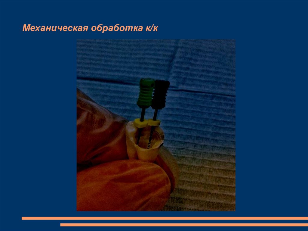 Механическая обработка к/к