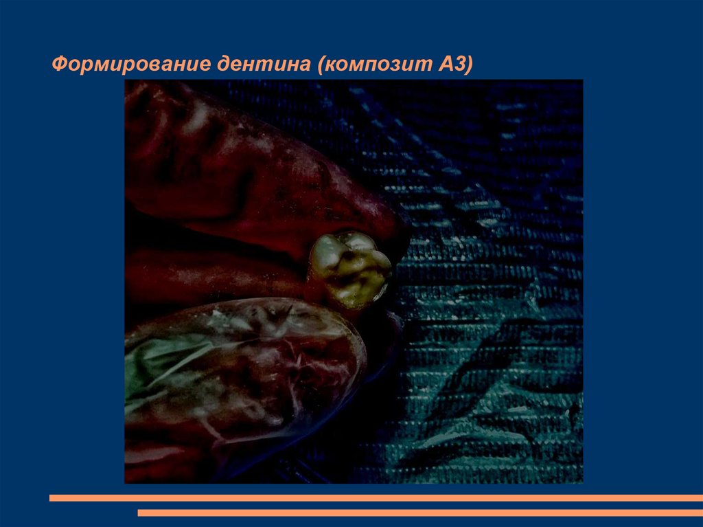 Формирование дентина (композит А3)