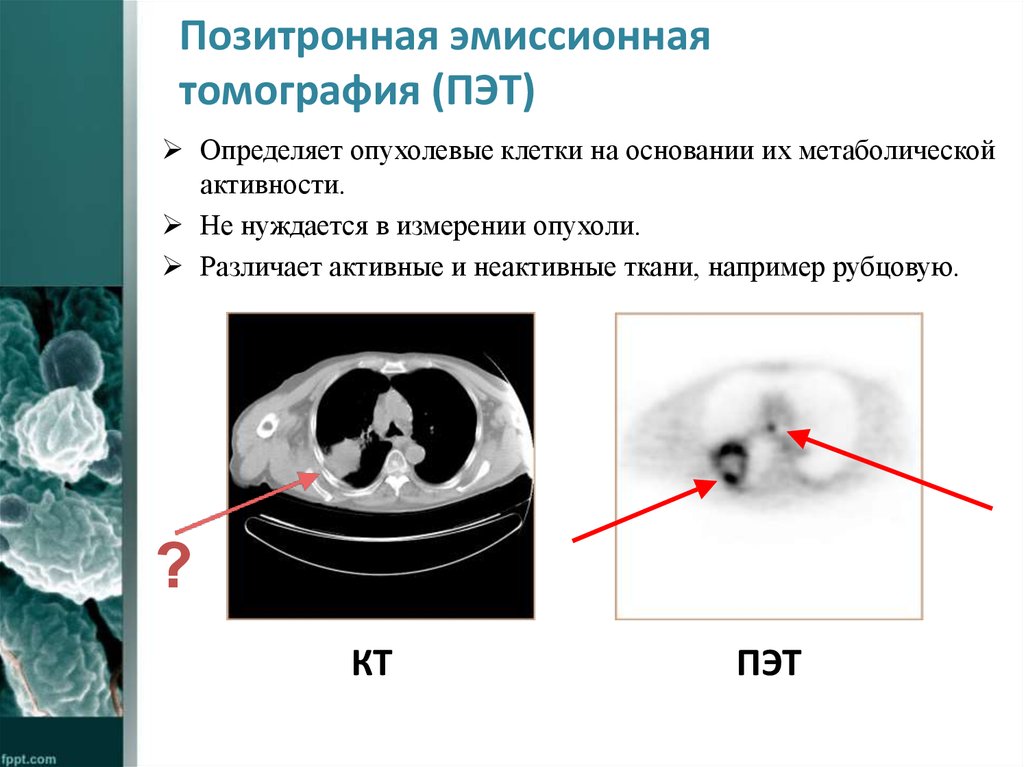 Пэт кт или кт что лучше. Позитронная двухфотонная эмиссионная томография (ПЭТ). Позитронно-эмиссионная томография при опухолях костей. Позитрон но-эмиссионная томография (ПЭ. ПЭТ кт снимок.