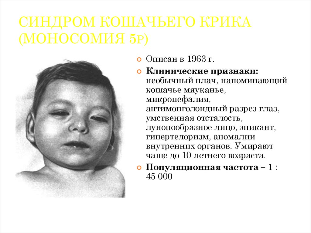 download die konnatale zytomegalievirusinfektion epidemiologie diagnose therapie 2003