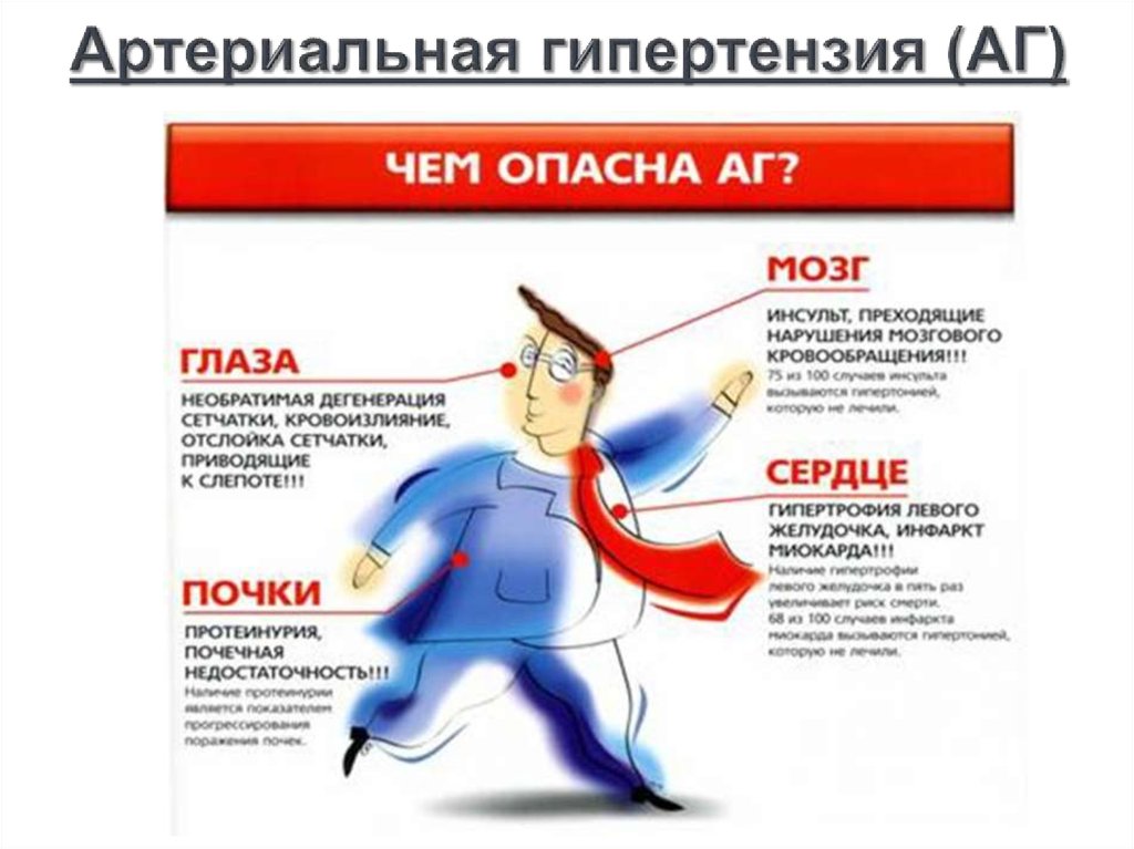 Артериальная гипертензия (АГ)