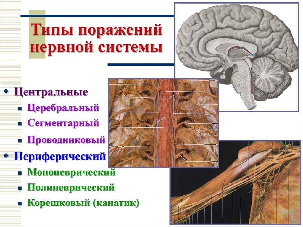 Виды поражений нервной системы