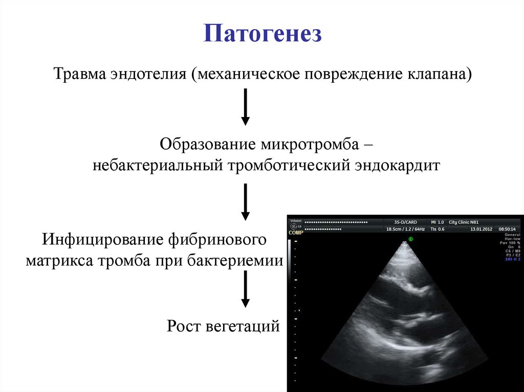 Презентация эндокардиты у детей