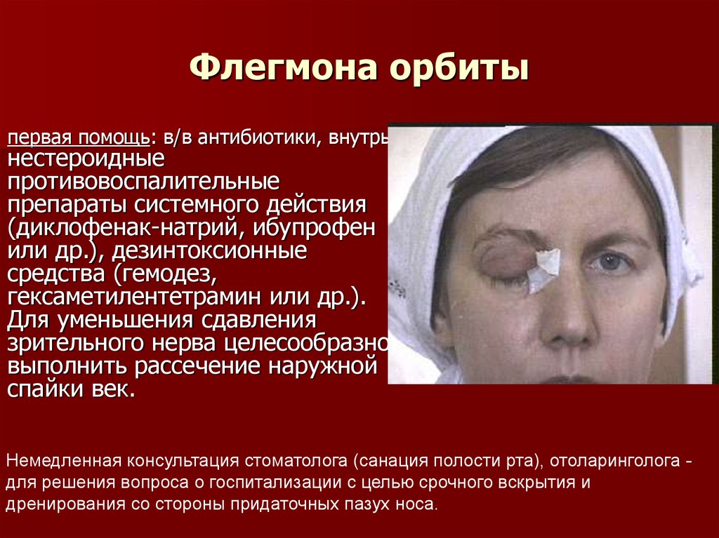 Первая врачебная помощь при острых состояниях и травмах органа зрения ...