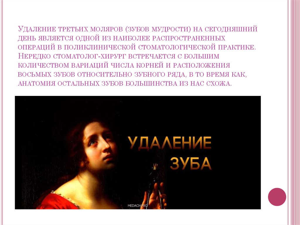 Удаление третьих моляров верхней и нижней челюсти. Ретенция и дистопия ...