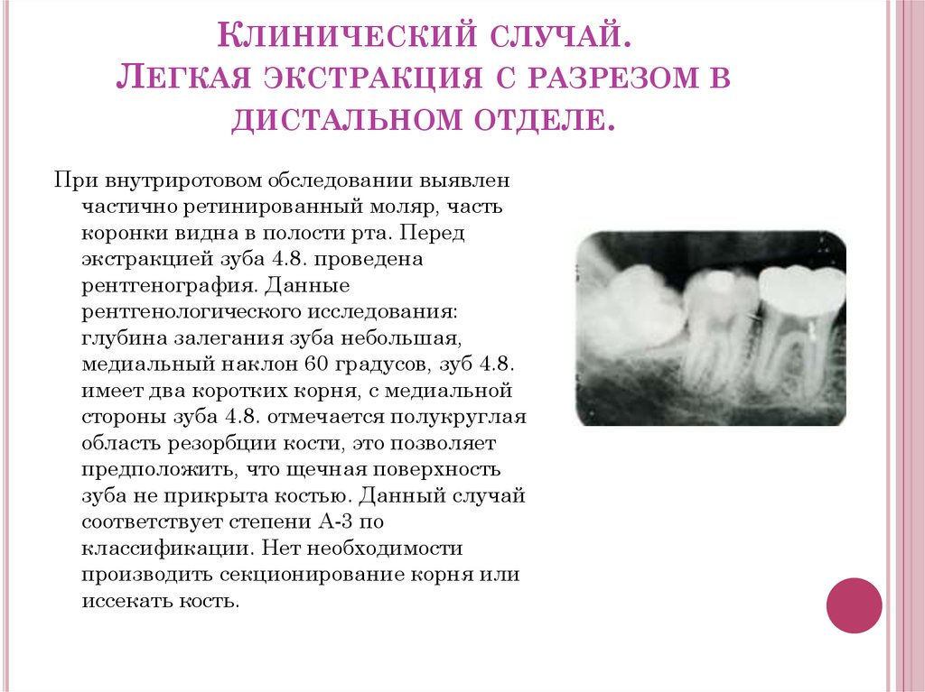 Экстракция зуба карта вызова скорой медицинской