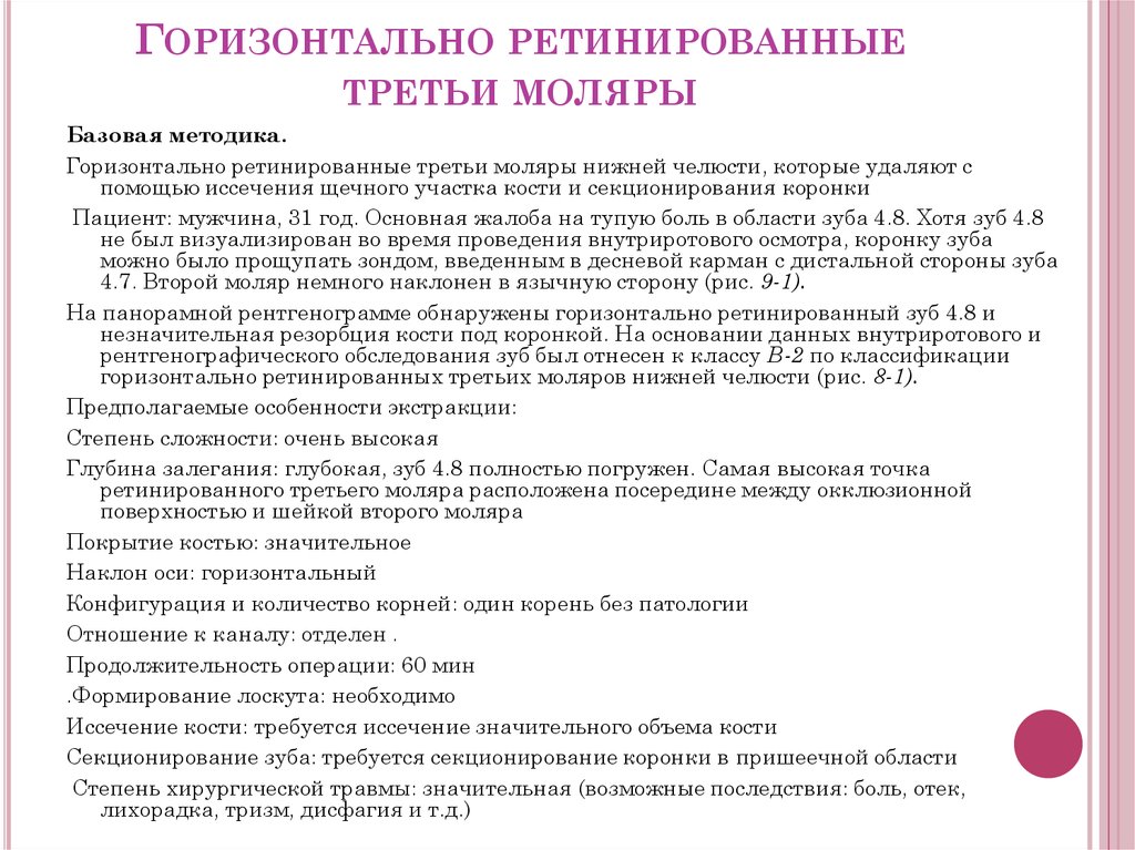 Горизонтально ретинированные третьи моляры