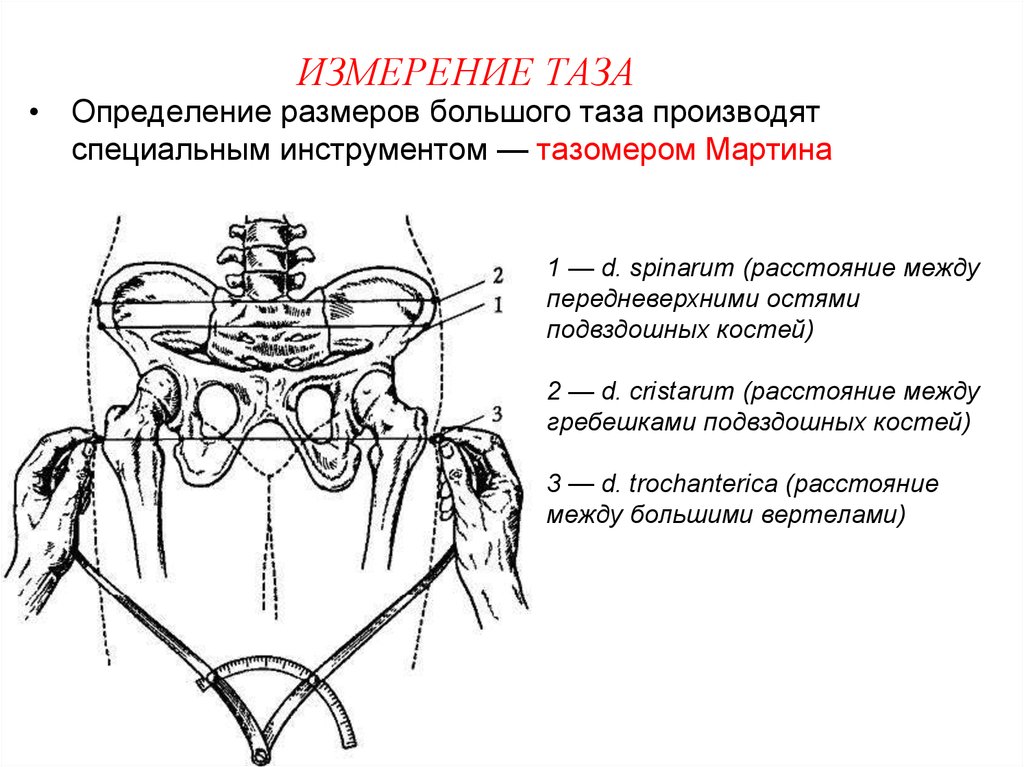 Измерение таза картинки