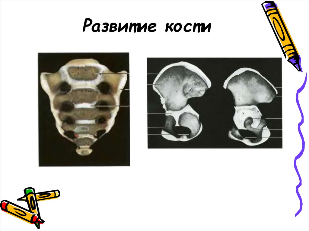 Формирование костей. Кости по развитию. Костное формирование. Кость развитие.