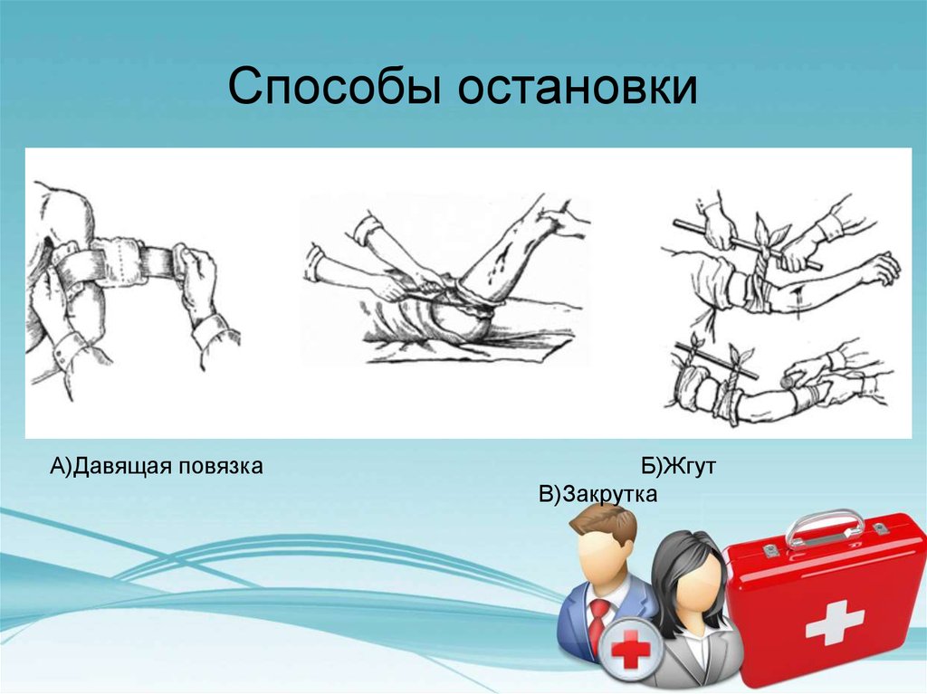 Способы остановки. Методы остановки кровотечения хирургия. Давящая повязка жгут закрутка. Способы искусственной остановки кровотечения. Остановка кровотечения топографическая анатомия.