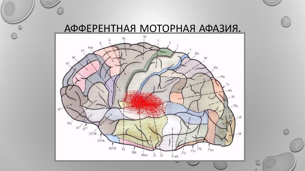 Афферентная афазия. Афферентная моторная афазия зона поражения. Эфферентная моторная афазия локализация очага поражения. Кинестетическая моторная афазия. Афферентная моторная афазия локализация поражения.