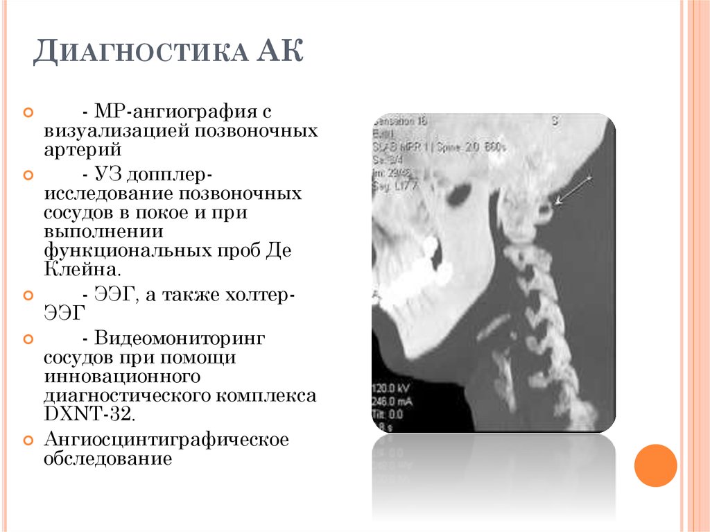 Неполная аномалия киммерли