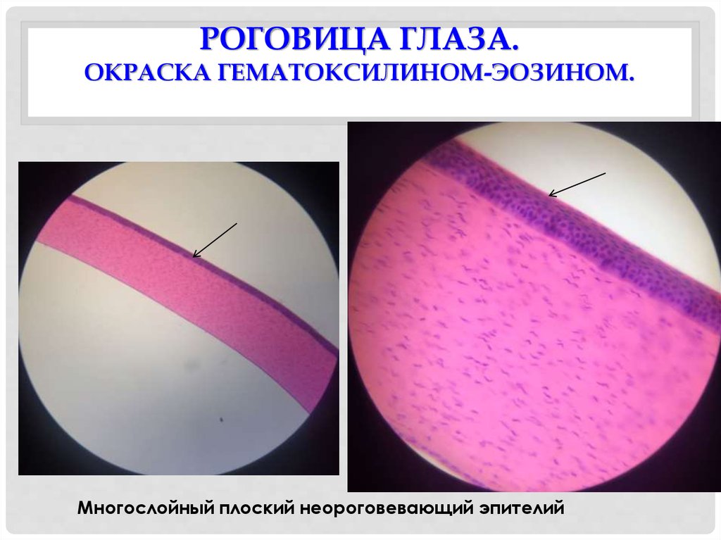 Рисунок роговицы глаза гистология