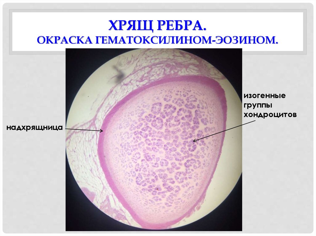 Гиалиновый хрящ гистология