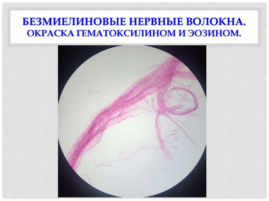 Безмиелиновые нервные волокна гистология рисунок