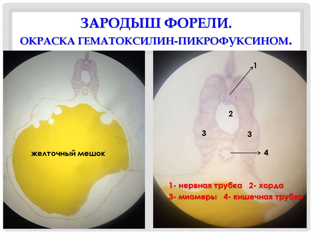 Желточный мешок. Желточный мешок гистология препарат. Зародыш форели с желточным мешком. Зародыш форели гематоксилин-пикрофуксин. Строение зародыша форели с желточным мешком.