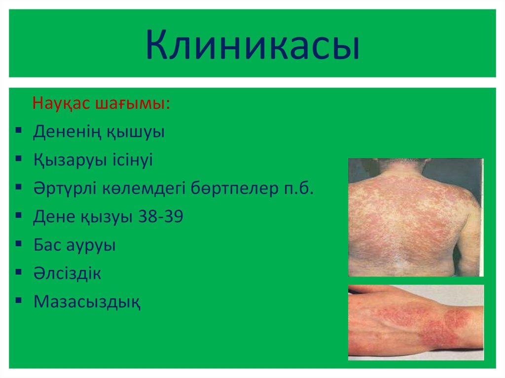 Есекжем - презентация онлайн