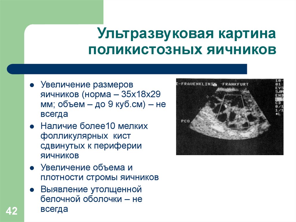Размер матки и яичников. Размеры яичника по УЗИ В норме. Ультразвуковая картина поликистоз яичников. Объем яичников в норме. Размеры яичника в норме.