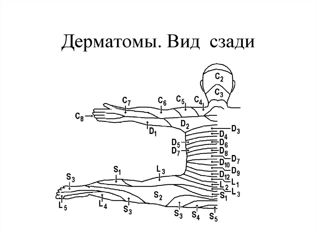 Дерматомы в неврологии схема