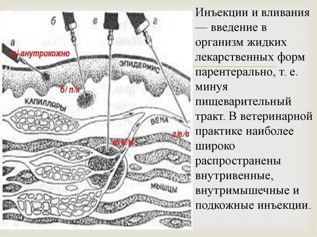 Анатомические места для внутрикожной инъекции