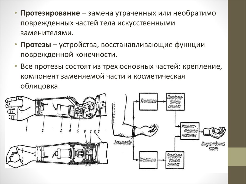 Схема бионического протеза