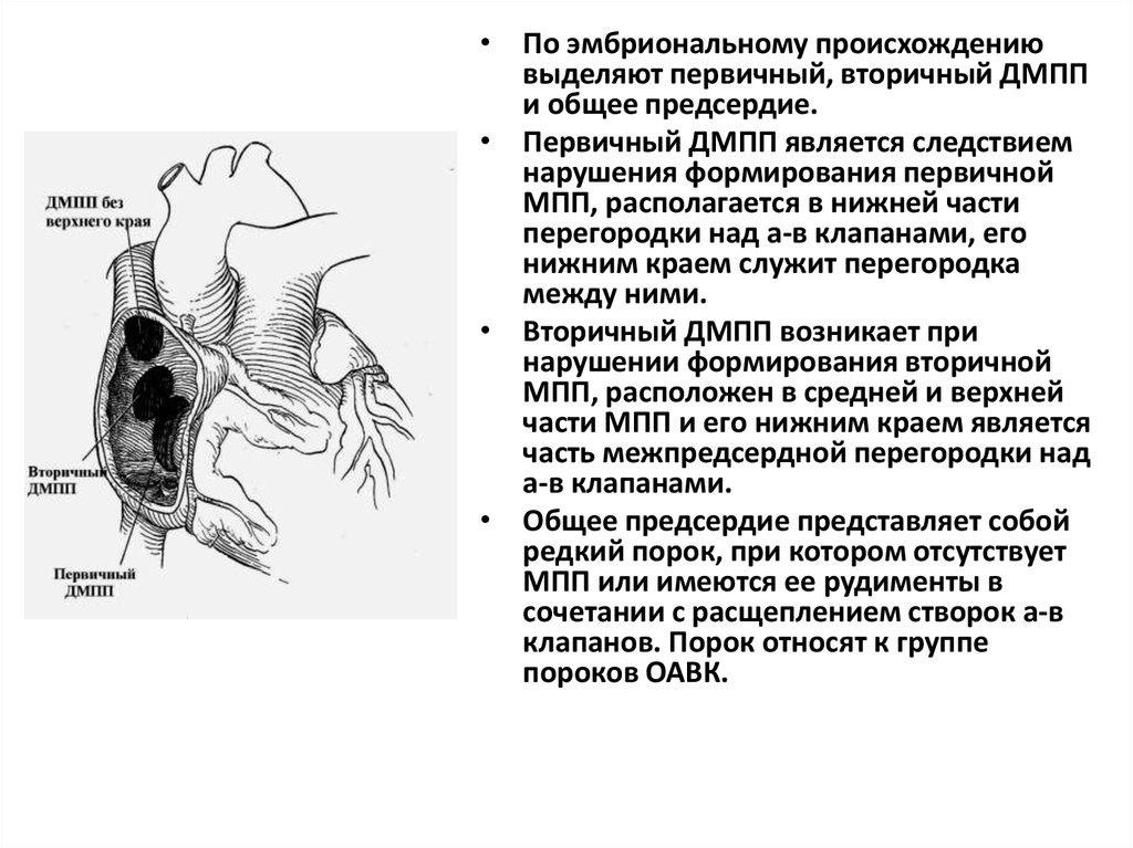 Дмпп у детей презентация