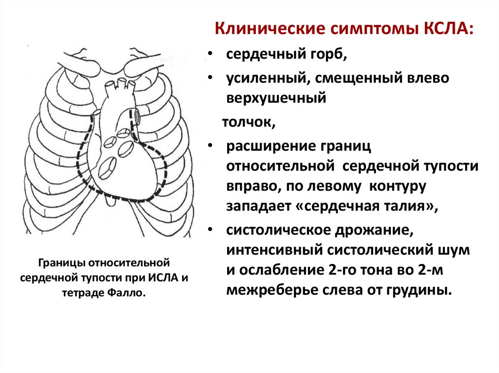 Особенность аускультативной картины сердца у детей