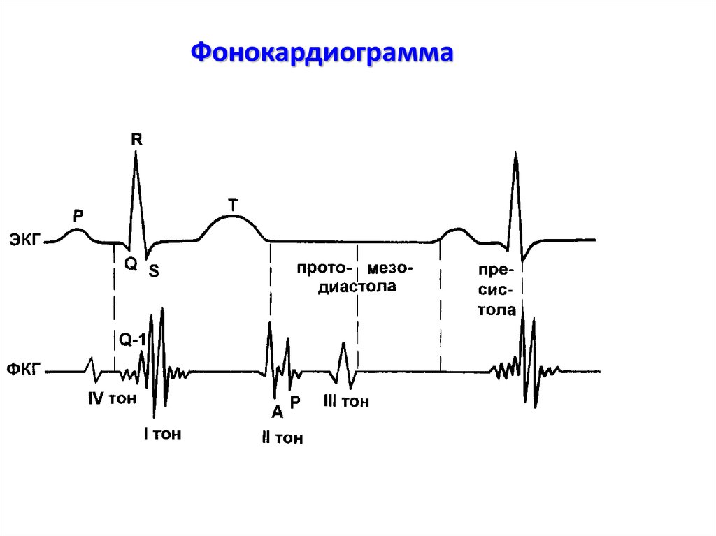 Графическое изображение тонов сердца