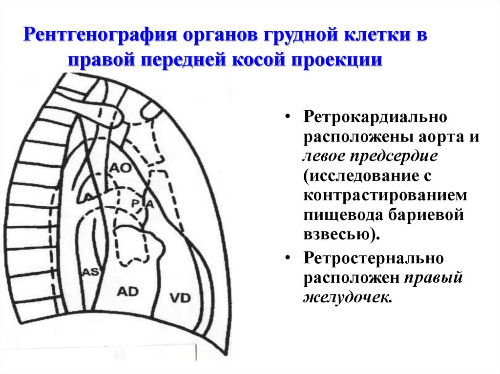 Проекции рентгенографии. Рентген органов грудной клетки в правой боковой проекции. Проекции рентгена грудной клетки. Рентген грудной клетки в передней проекции. Левая боковая проекция грудной клетки рентген.