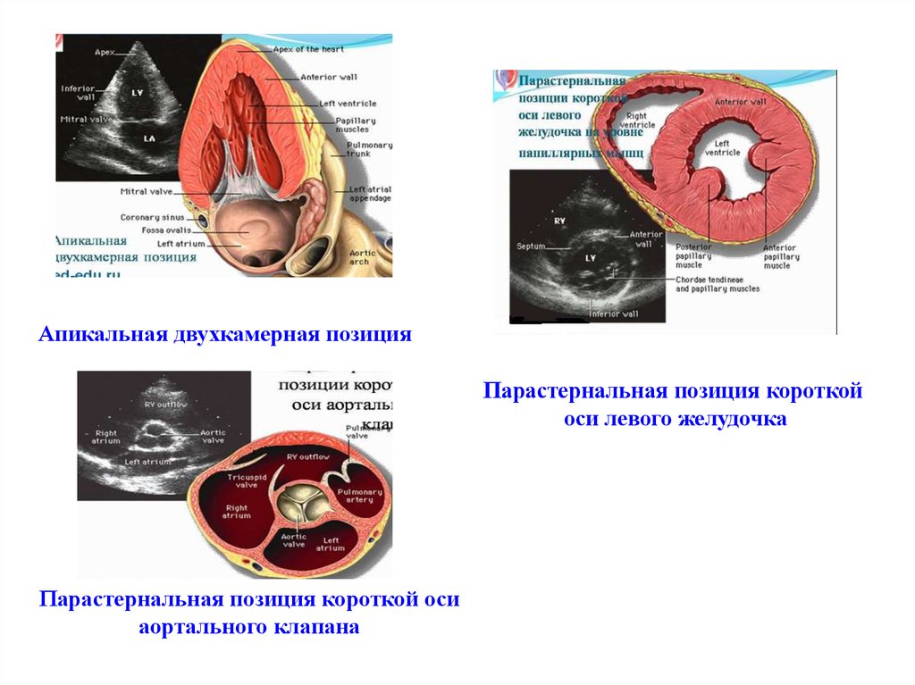 Презентация сестринский процесс при пороках сердца