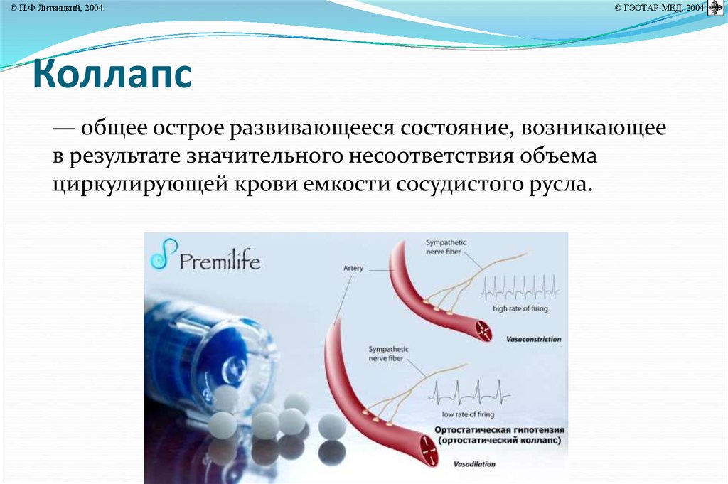 Что такое коллапс. Коллапс. Коллапс презентация. Коллапс это в патологии. Коллапс сосудов.