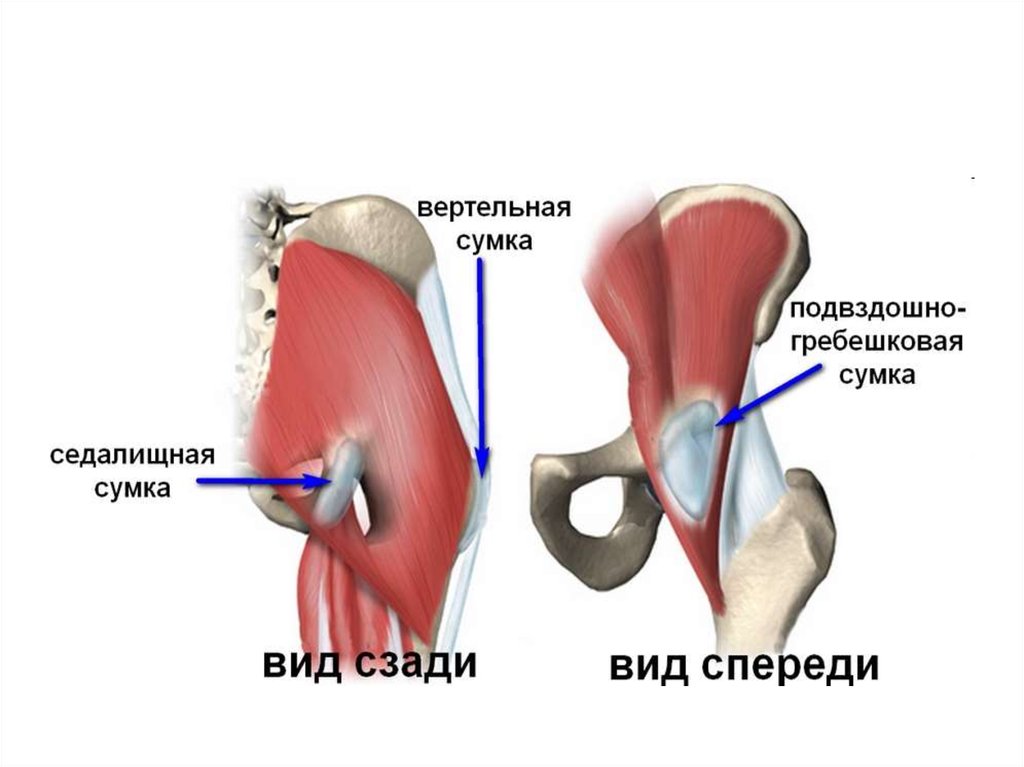 Бурсит тазобедренного сустава симптомы и лечение. Вертельная сумка тазобедренного сустава. Вертельная сумка тазобедренного сустава анатомия. Вертельный бурсит трохантерит.