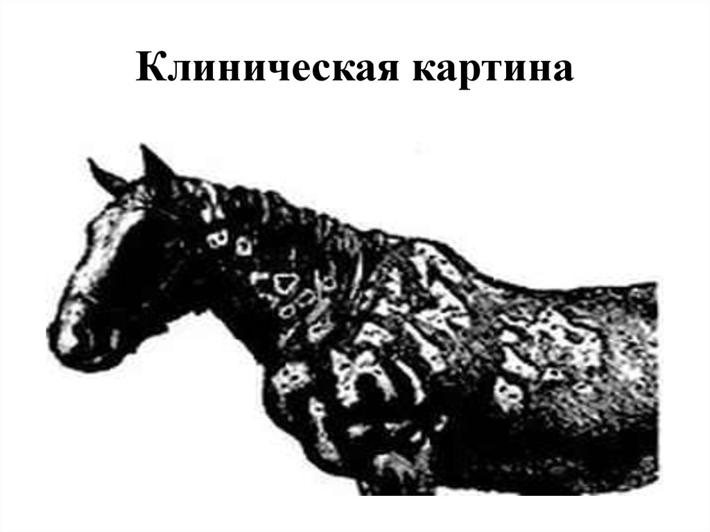 Клиническая картина