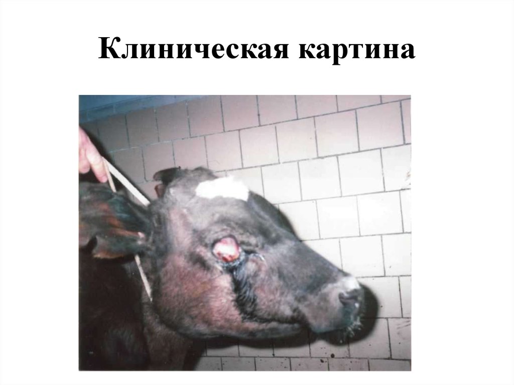 Клиническая картина