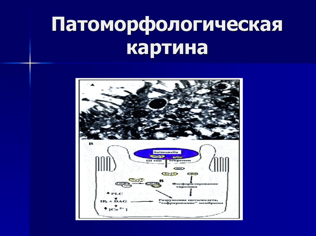 Патоморфологическая картина это