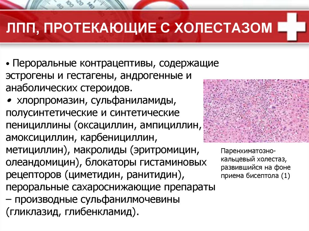 Холестаз что это такое симптомы у женщин