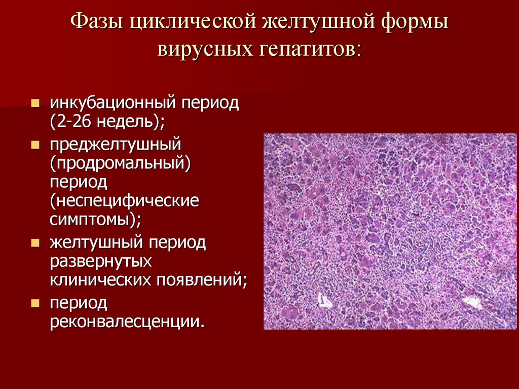 Вирусный гепатит желтушный период