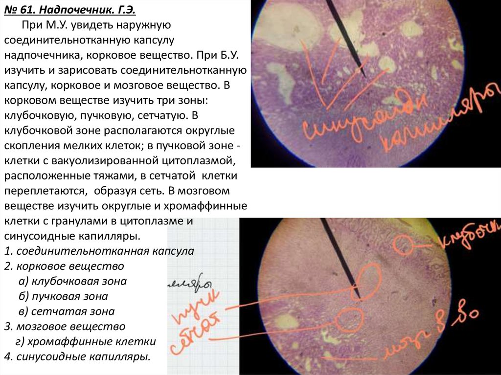 Хромаффинные клетки надпочечников