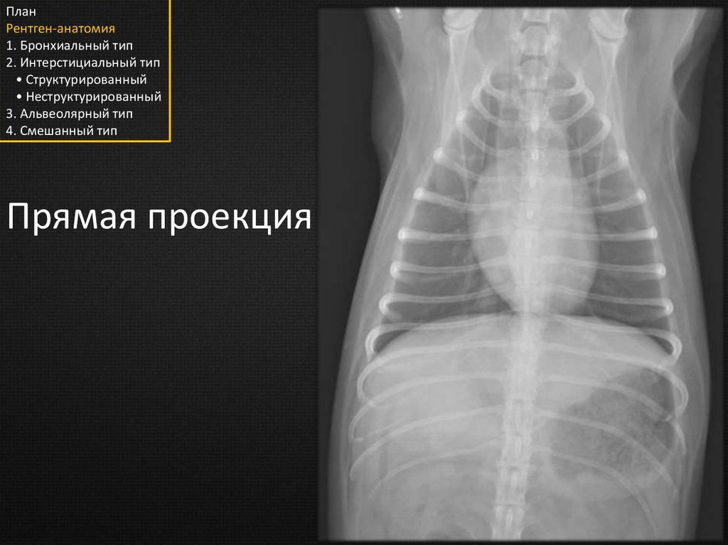 Анатомия рентген. Рентгенологическая анатомия. Рентгенограммы анатомия. Рентген анатомия лёгких.