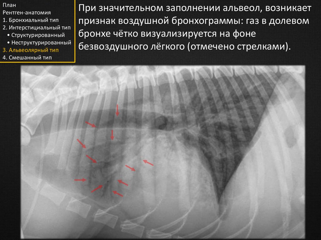 Анатомия рентген