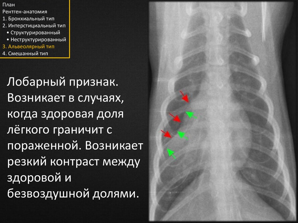 Анатомия рентген