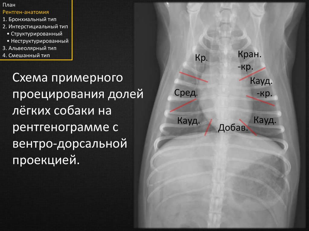 Рентген екатеринбург. Рентгенологическая анатомия. Рентген анатомия лёгких. Доли на рентгенограмме. Доли лёгкого на рентгене.