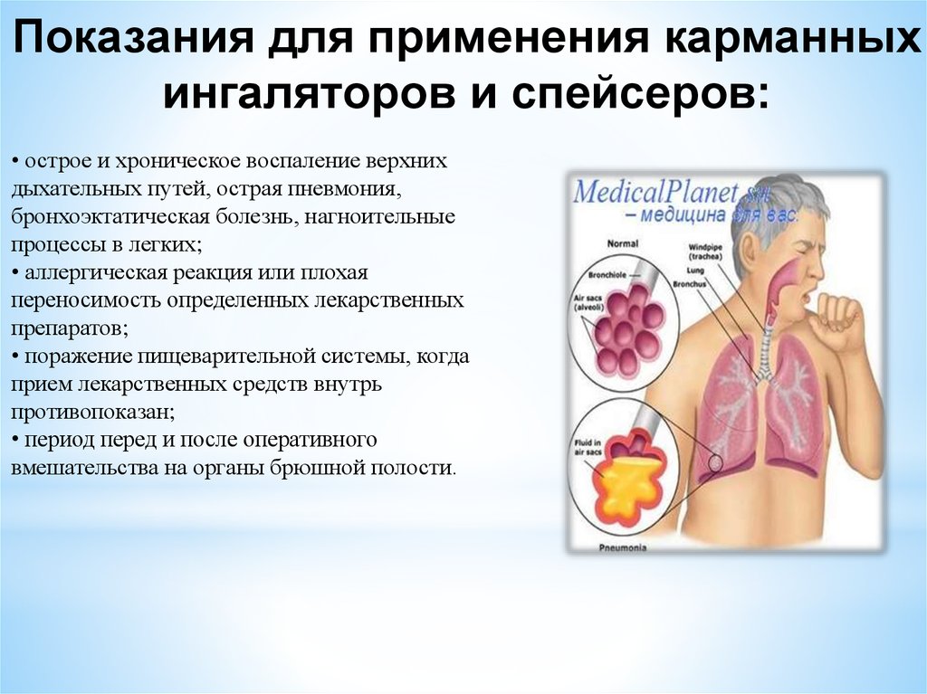 Лечение дыхательных путей. Хронические болезни верхних дыхательных путей. Острая вирусная инфекция верхних дыхательных путей. Воспалительные заболевания верхних дыхательных путей. Острое воспаление верхних дыхательных путей.