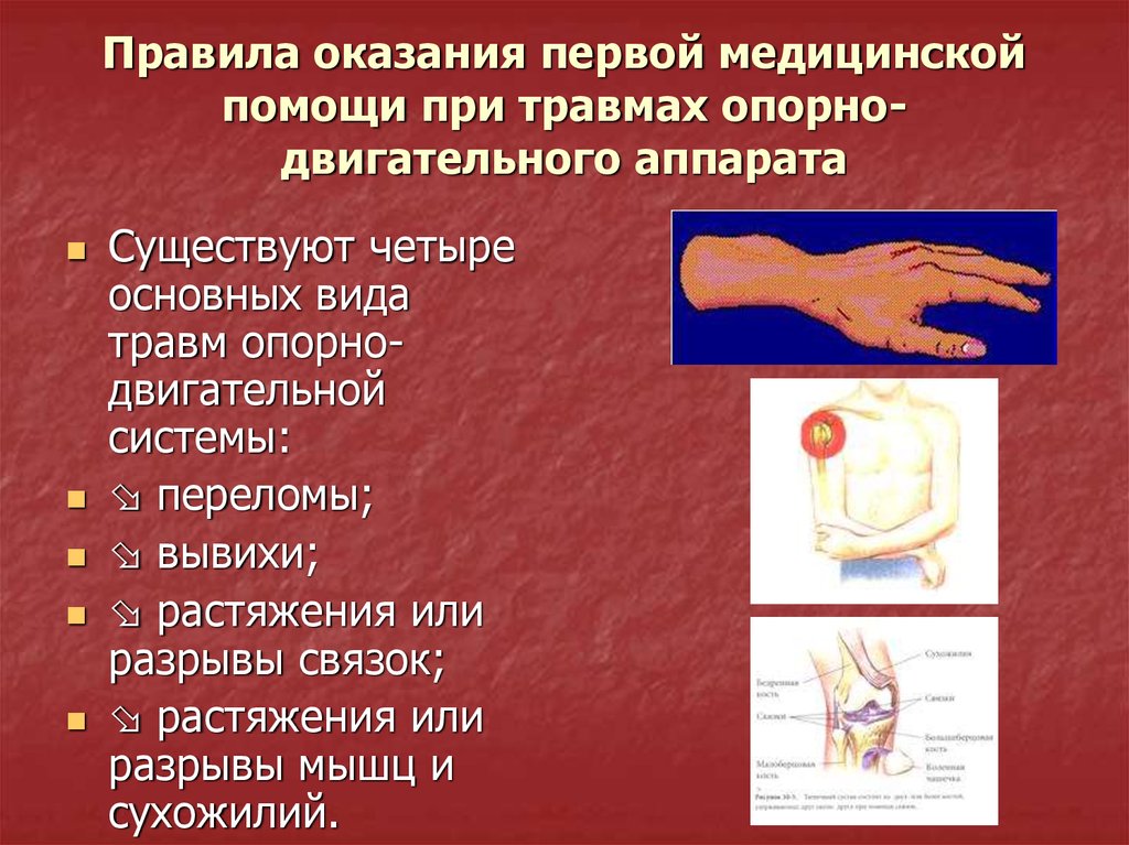 Виды травм и первая помощь при травмах презентация