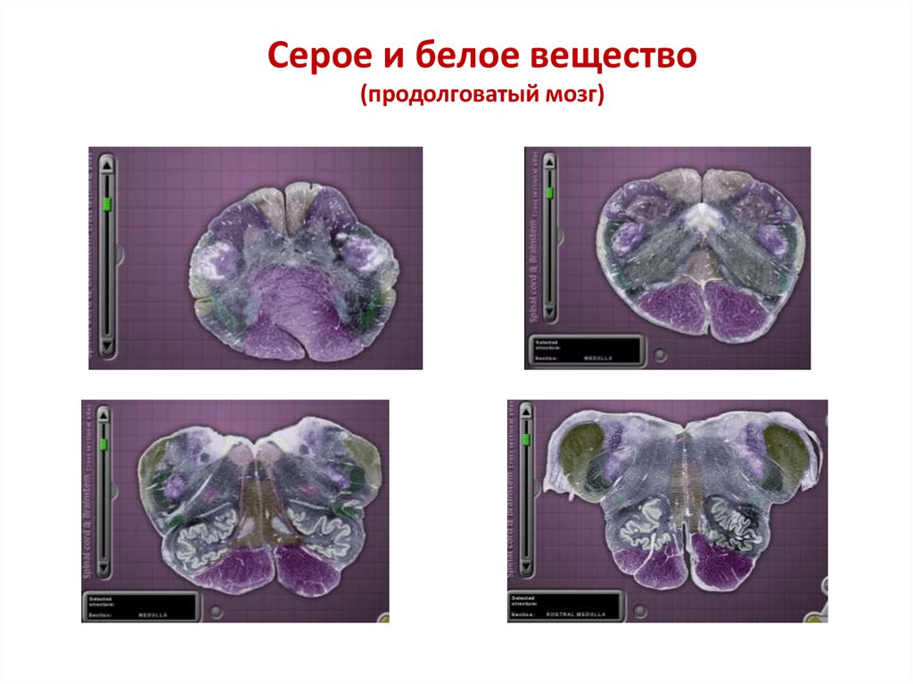 Мозговой серый. Продолговатый мозг структура белого вещества. Продолговатый мозг серое и белое вещество. Серое вещество продолговатого мозга. Строение серого и белого вещества продолговатого мозга.