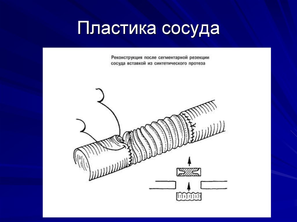 Кто открыл сосудосуживающие сосуды опишите схему опыта