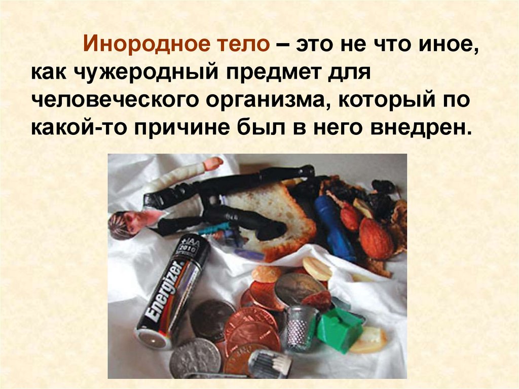 Инородное тело. Посторонние предметы в продуктах. Посторонние предметы в пищевых продуктах презентация. Внедрять в тело инородные тела.