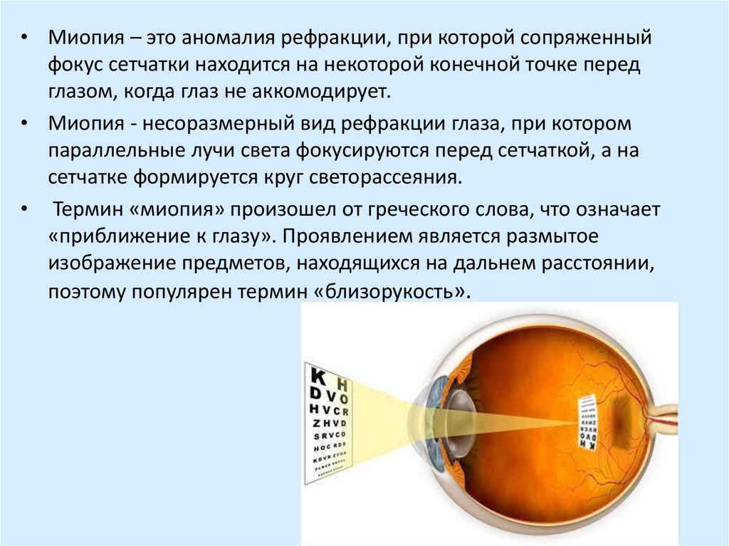 Миопия при беременности презентация