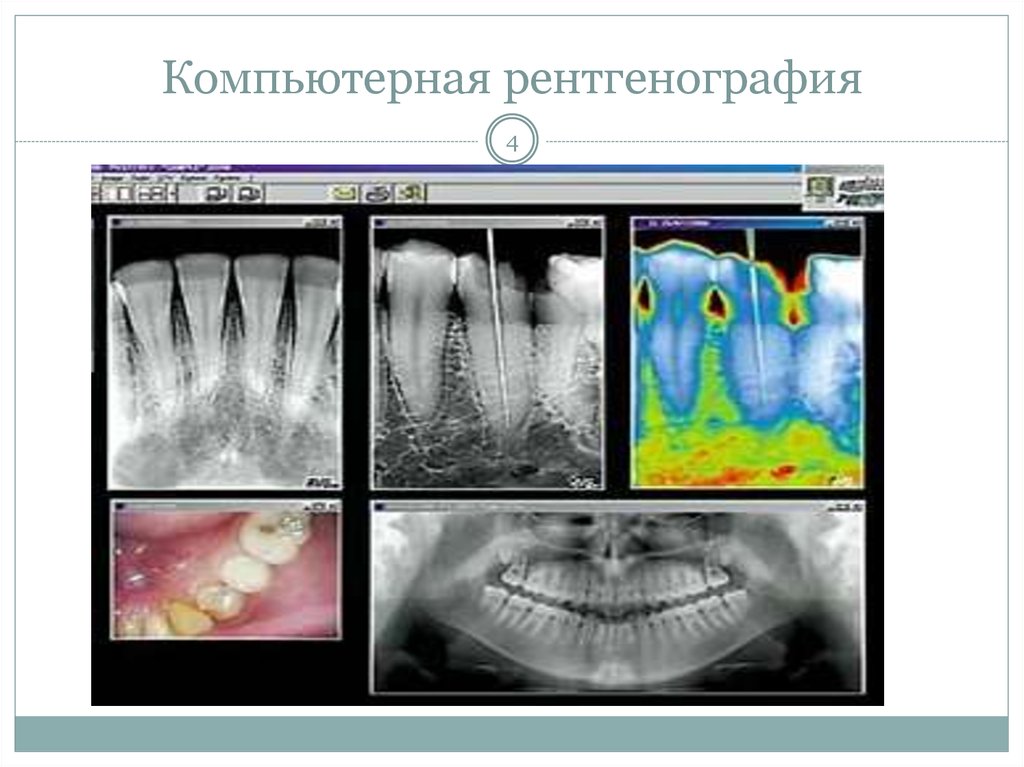 Компьютерная технология трудности передачи на расстояние легкость копирования